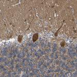 CIT Antibody in Immunohistochemistry (Paraffin) (IHC (P))