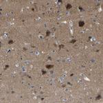 CIT Antibody in Immunohistochemistry (Paraffin) (IHC (P))