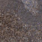 CIT Polyclonal Antibody