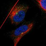 IFT81 Polyclonal Antibody