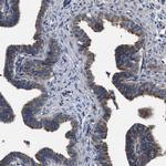 IFT81 Antibody in Immunohistochemistry (Paraffin) (IHC (P))