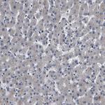 IFT81 Antibody in Immunohistochemistry (Paraffin) (IHC (P))