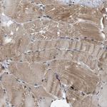 IFT81 Antibody in Immunohistochemistry (Paraffin) (IHC (P))