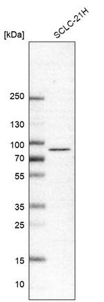 IFT81 Antibody in Western Blot (WB)