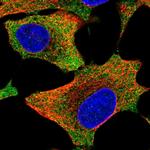 JTV-1 Polyclonal Antibody