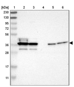 JTV-1 Antibody in Western Blot (WB)