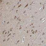 MIB1 Antibody in Immunohistochemistry (Paraffin) (IHC (P))