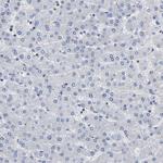 PTPN7 Antibody in Immunohistochemistry (Paraffin) (IHC (P))