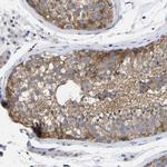 PTPN7 Antibody in Immunohistochemistry (Paraffin) (IHC (P))
