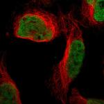 QKI Polyclonal Antibody