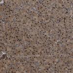 FAM161B Polyclonal Antibody