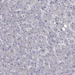 Adenylate Kinase 5 Antibody in Immunohistochemistry (IHC)