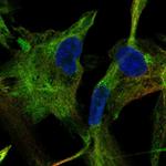 Adenylate Kinase 5 Polyclonal Antibody