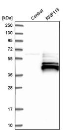RNF115 Antibody in Western Blot (WB)