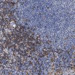 GIMAP4 Antibody in Immunohistochemistry (IHC)