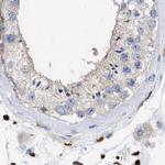 GIMAP4 Antibody in Immunohistochemistry (IHC)