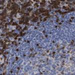GIMAP4 Antibody in Immunohistochemistry (IHC)