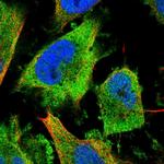 NUDCD3 Polyclonal Antibody