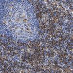 GIMAP4 Antibody in Immunohistochemistry (IHC)
