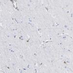 GIMAP4 Antibody in Immunohistochemistry (IHC)