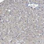 PHIP Antibody in Immunohistochemistry (Paraffin) (IHC (P))