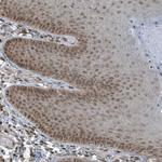 PHIP Antibody in Immunohistochemistry (Paraffin) (IHC (P))