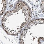 PHIP Antibody in Immunohistochemistry (Paraffin) (IHC (P))