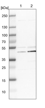 UQCRC2 Antibody in Western Blot (WB)