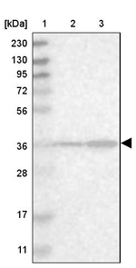 SPATC1L Antibody in Western Blot (WB)