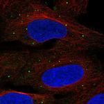 TMEM68 Polyclonal Antibody