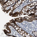 TMEM154 Polyclonal Antibody