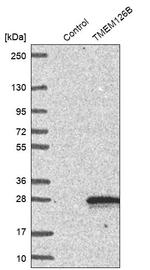 TMEM126B Antibody in Western Blot (WB)
