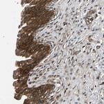 FGD5 Polyclonal Antibody
