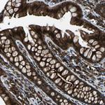 SCAMP2 Polyclonal Antibody