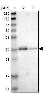 SCAMP2 Antibody in Western Blot (WB)