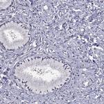 HCN1 Polyclonal Antibody