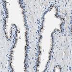 BRICD5 Polyclonal Antibody