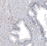 TMEM43 Polyclonal Antibody
