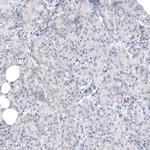 TMEM43 Antibody in Immunohistochemistry (IHC)
