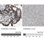 STARD3NL Antibody in Immunohistochemistry (IHC)
