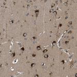 STARD3NL Antibody in Immunohistochemistry (IHC)