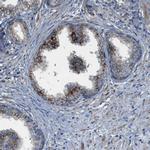 STARD3NL Antibody in Immunohistochemistry (IHC)