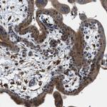 STARD3NL Antibody in Immunohistochemistry (IHC)