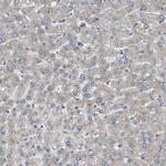 STARD3NL Antibody in Immunohistochemistry (IHC)