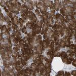 UBE4B Antibody in Immunohistochemistry (Paraffin) (IHC (P))