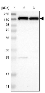 UBE4B Antibody in Western Blot (WB)