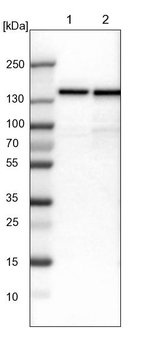 UBE4B Antibody in Western Blot (WB)