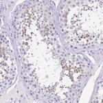 SPATA4 Polyclonal Antibody