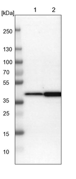 NANS Antibody in Western Blot (WB)