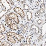 SMU1 Polyclonal Antibody